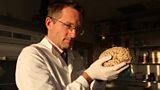 Michael Mosley holds a human brain