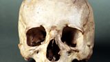 Van Dyck's skull