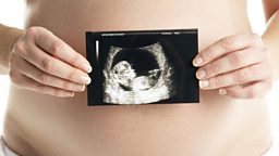 Pregnant women warned  on taking paracetamol 