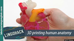 3D printing human anatomy